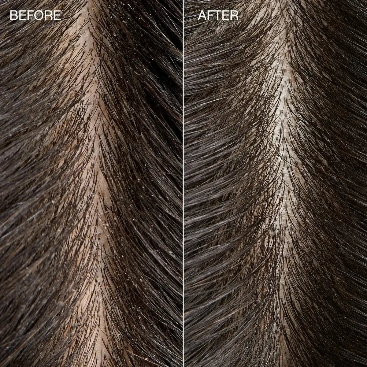 Tea Tree Special Detox Kombucha Rinse