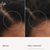 Scalp Revitalizing Treatment